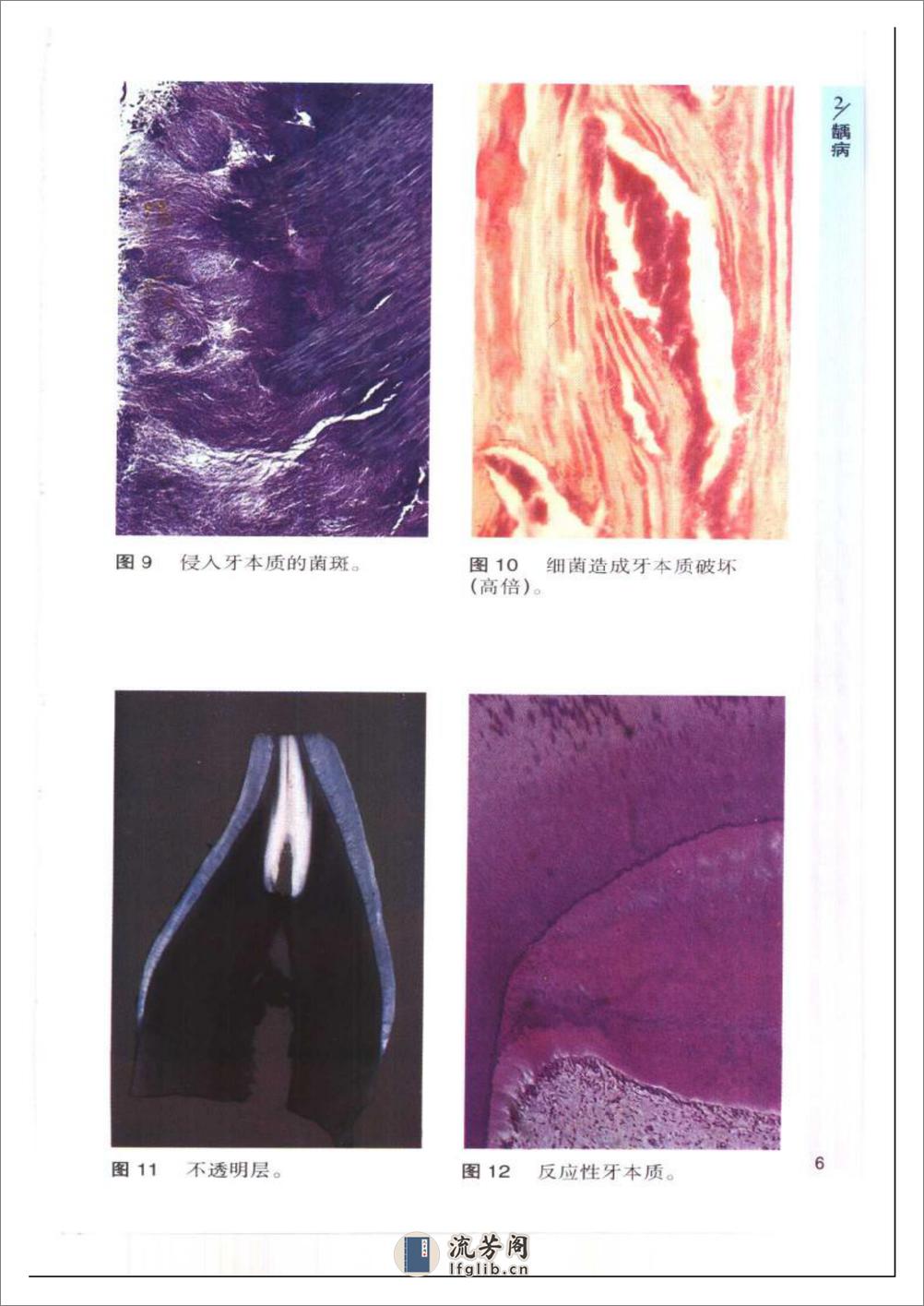 袖珍诊疗彩色图谱系列+口腔病理学 - 第12页预览图
