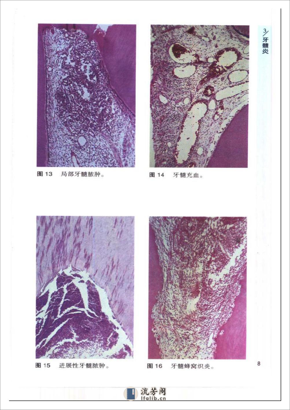 袖珍诊疗彩色图谱系列+口腔病理学 - 第14页预览图