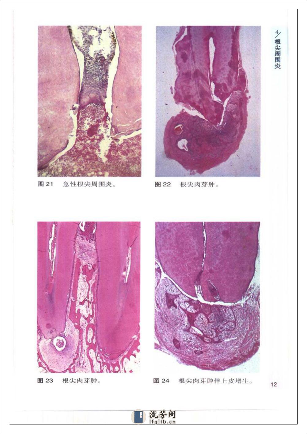 袖珍诊疗彩色图谱系列+口腔病理学 - 第18页预览图