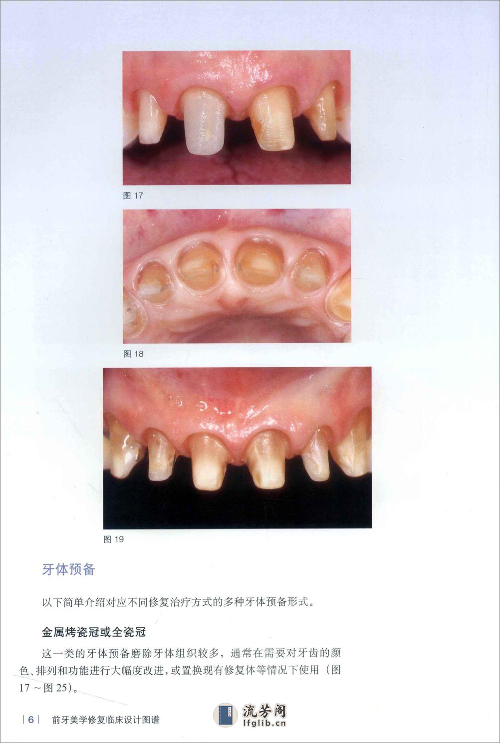 前牙美学修复临床设计图谱 - 第12页预览图