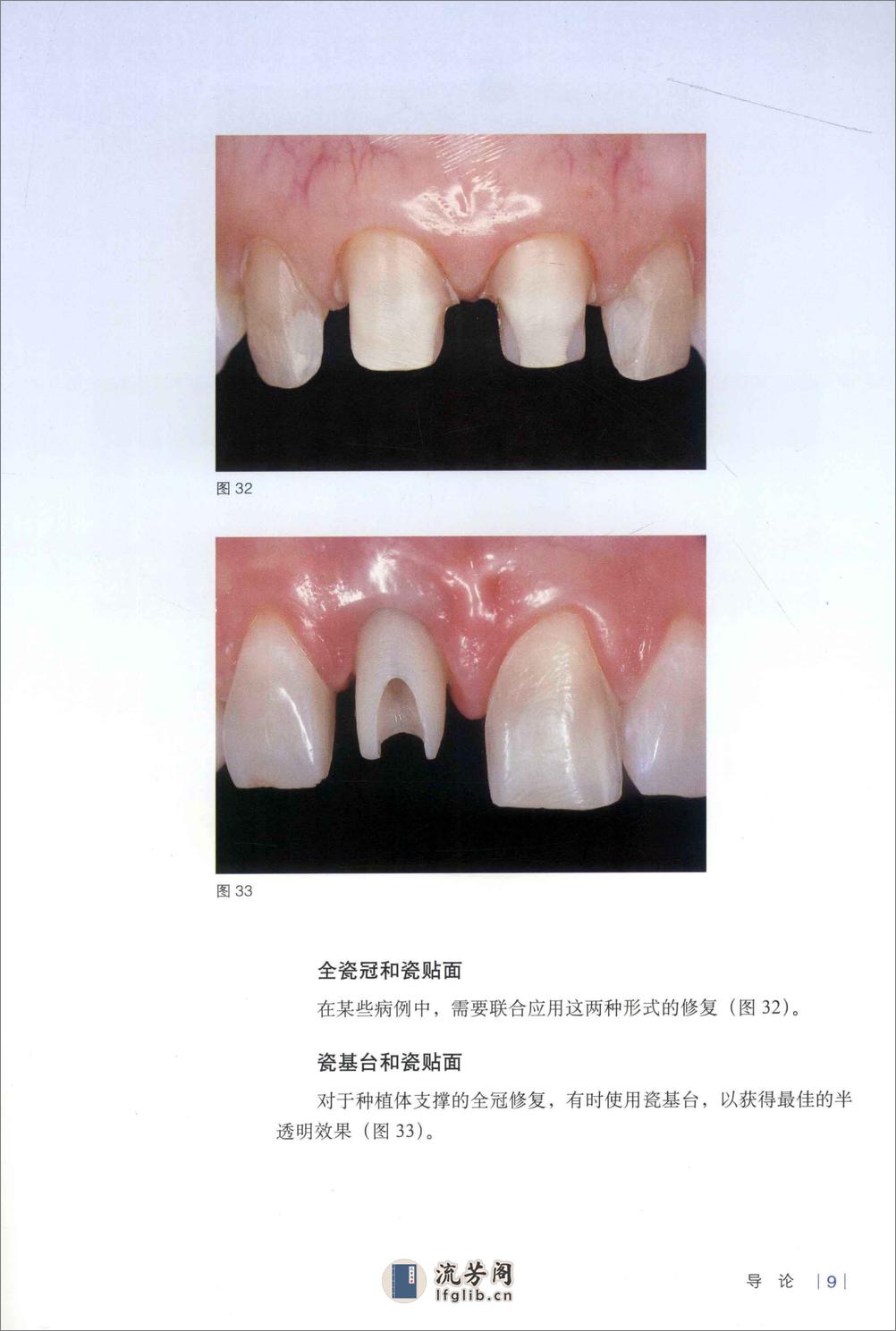 前牙美学修复临床设计图谱 - 第15页预览图