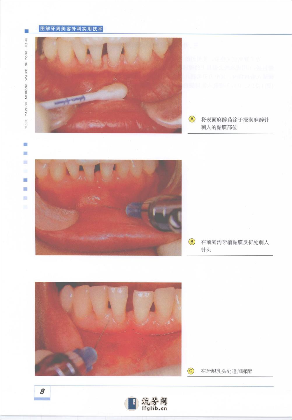 图解牙周美容外科实用技术_11929488 - 第14页预览图