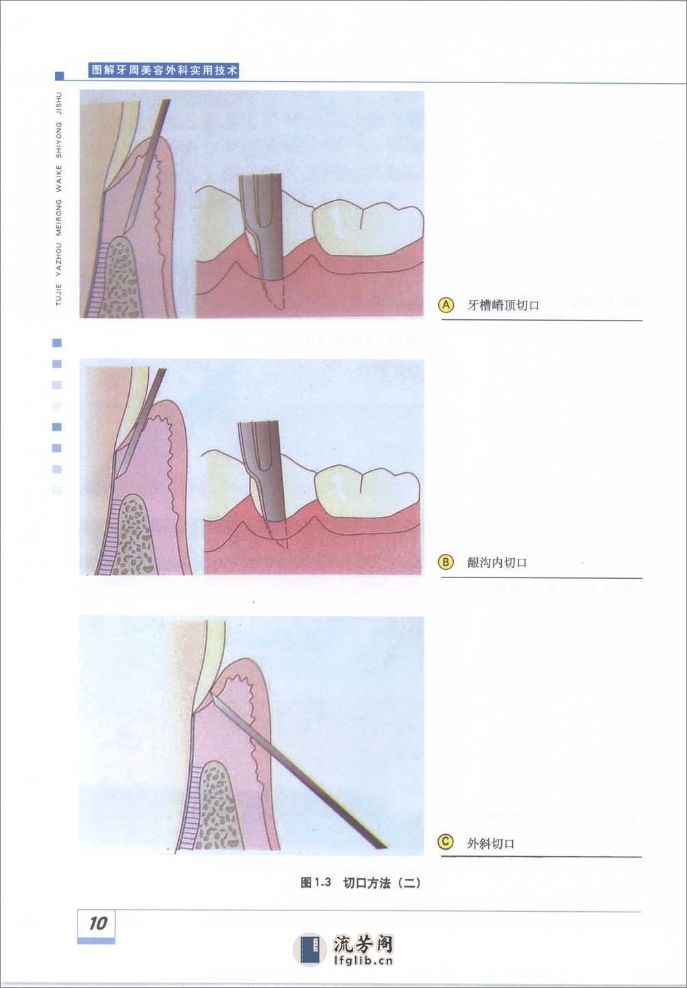 图解牙周美容外科实用技术_11929488 - 第16页预览图