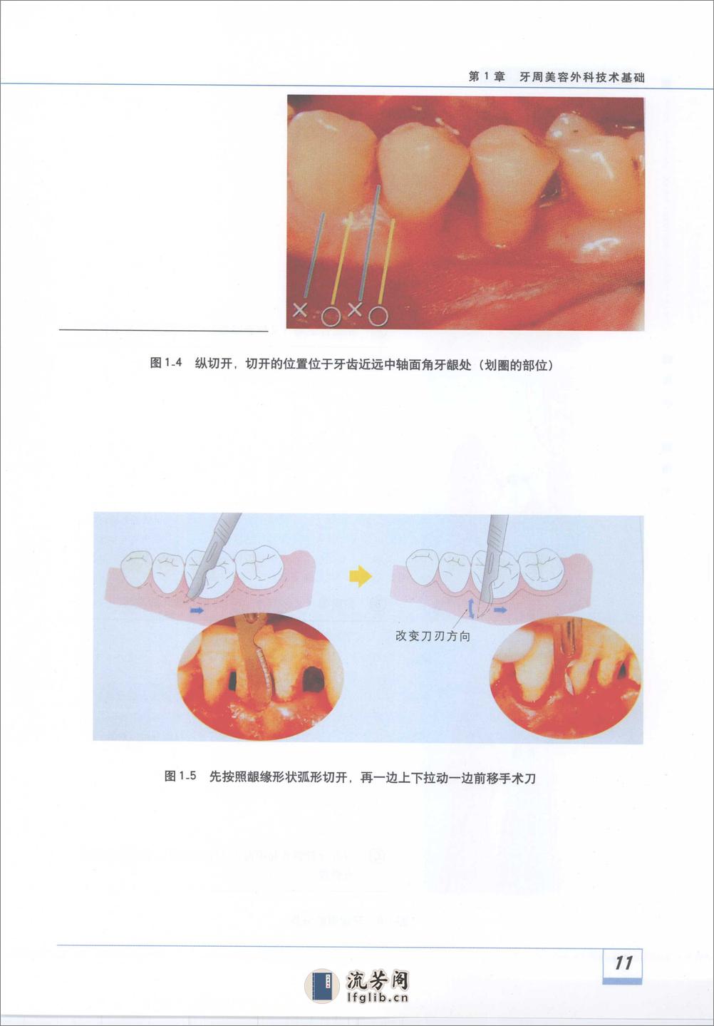 图解牙周美容外科实用技术_11929488 - 第17页预览图