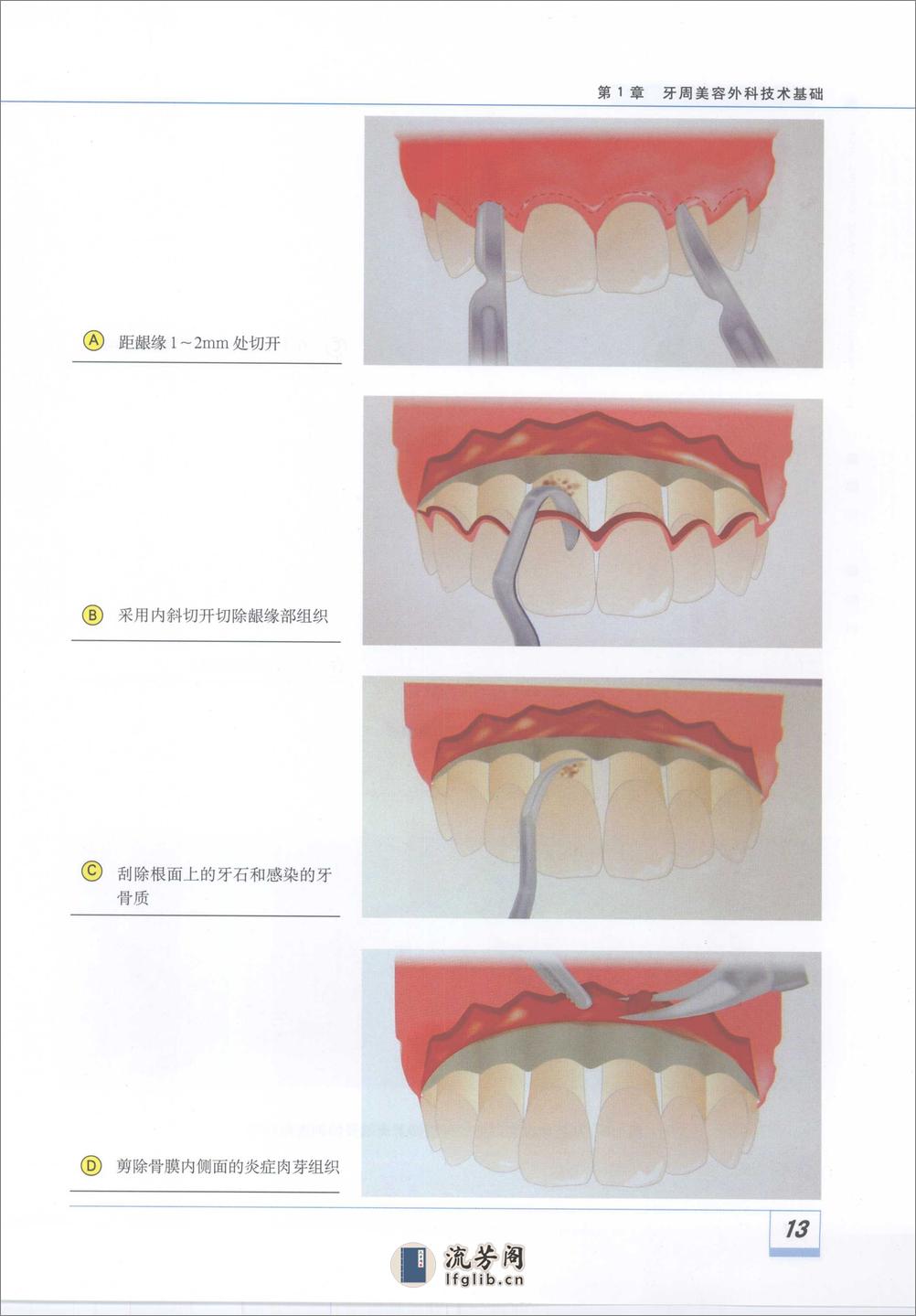 图解牙周美容外科实用技术_11929488 - 第19页预览图