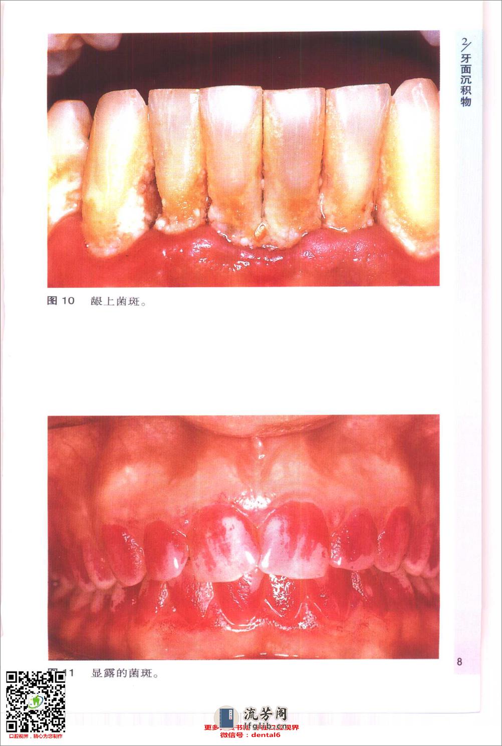 袖珍诊疗彩色图谱系列 牙周病学[英]希斯曼（Heasman，P.）等编著 - 第10页预览图