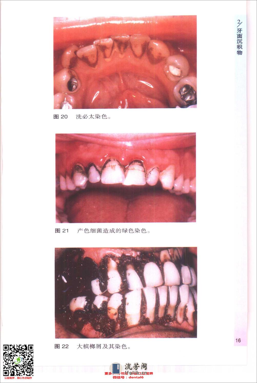 袖珍诊疗彩色图谱系列 牙周病学[英]希斯曼（Heasman，P.）等编著 - 第18页预览图