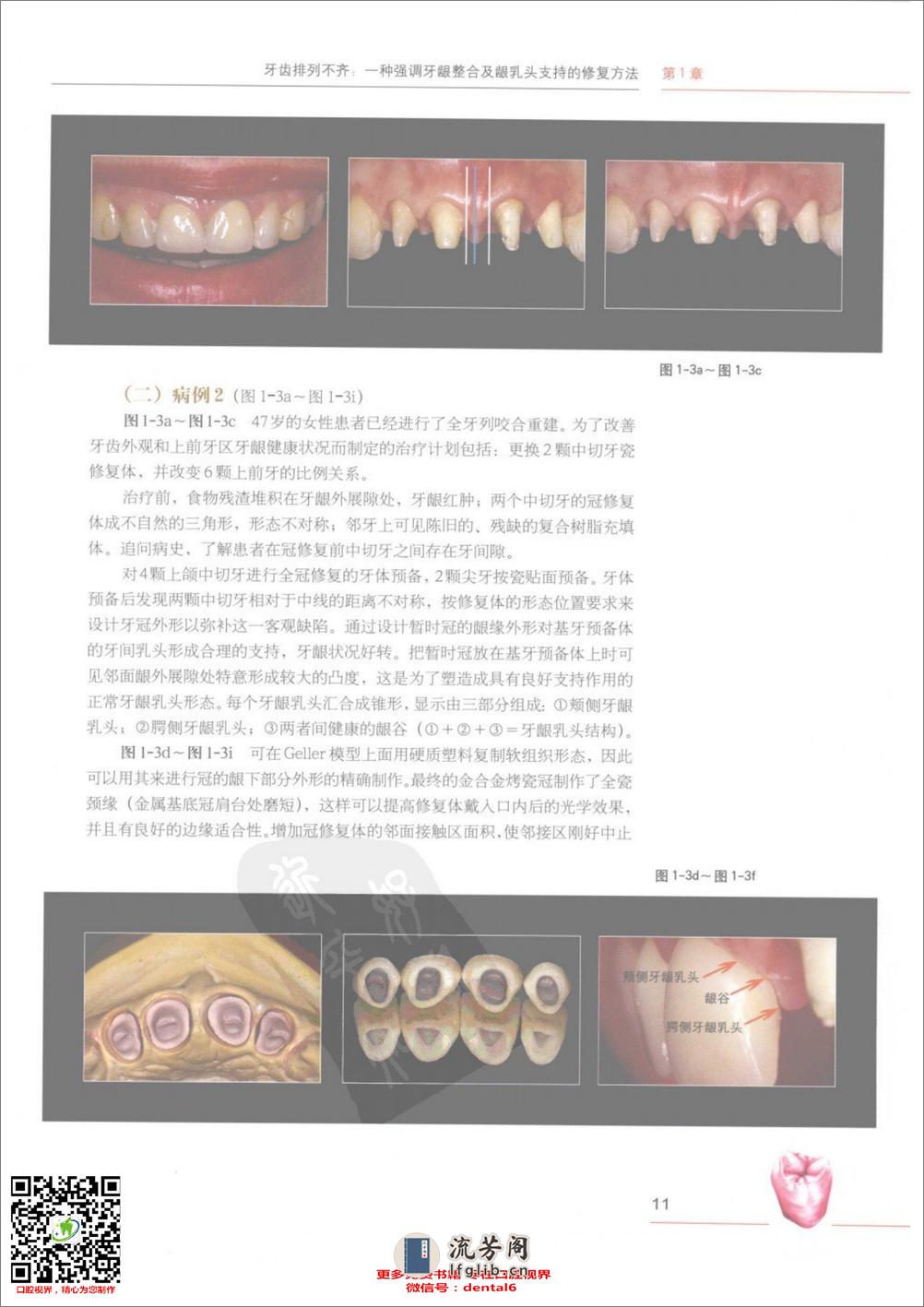 笑容的艺术_口腔多学科综合美学治_[1].. - 第20页预览图