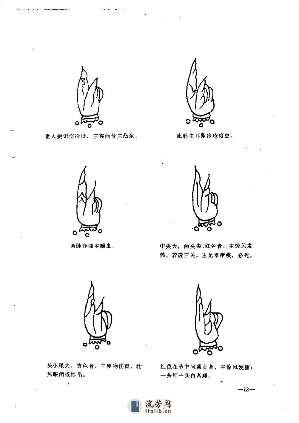 小儿推拿广意-[清]熊应雄 - 第20页预览图