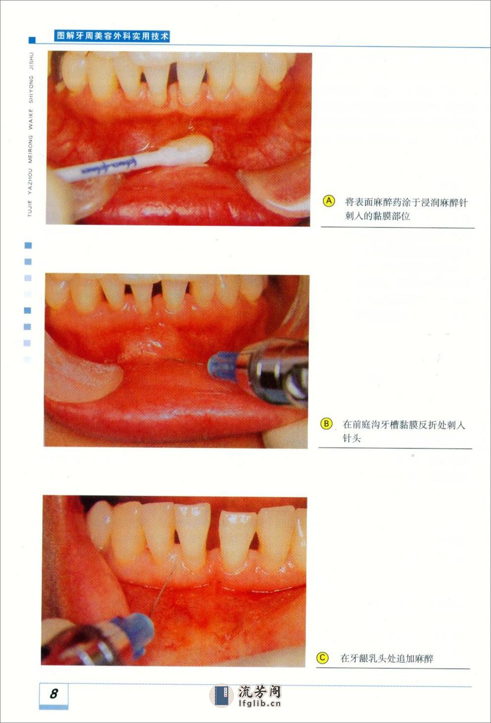 图解牙周美容外科实用技术 - 第16页预览图