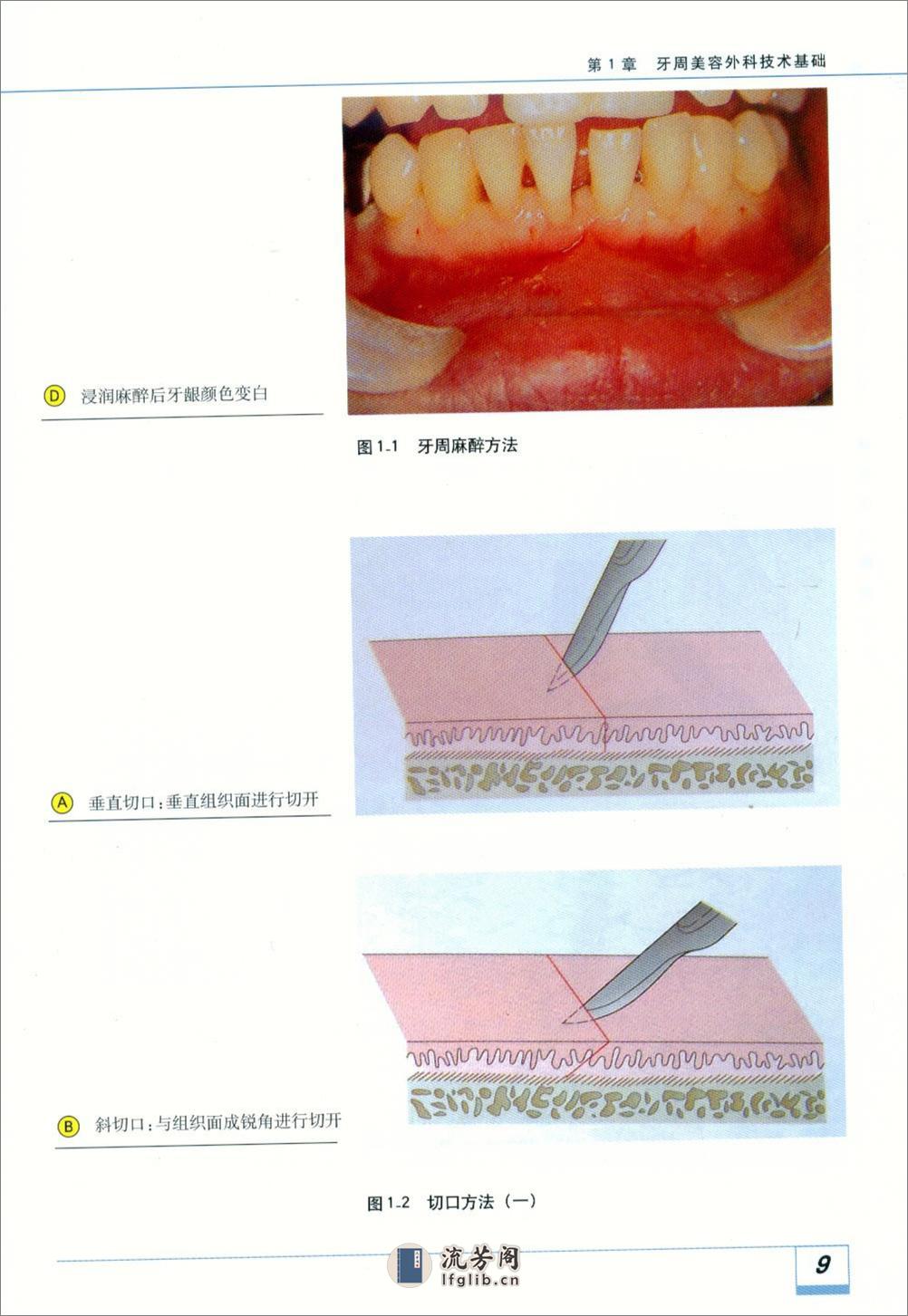 图解牙周美容外科实用技术 - 第17页预览图