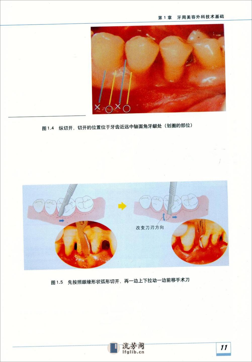 图解牙周美容外科实用技术 - 第18页预览图