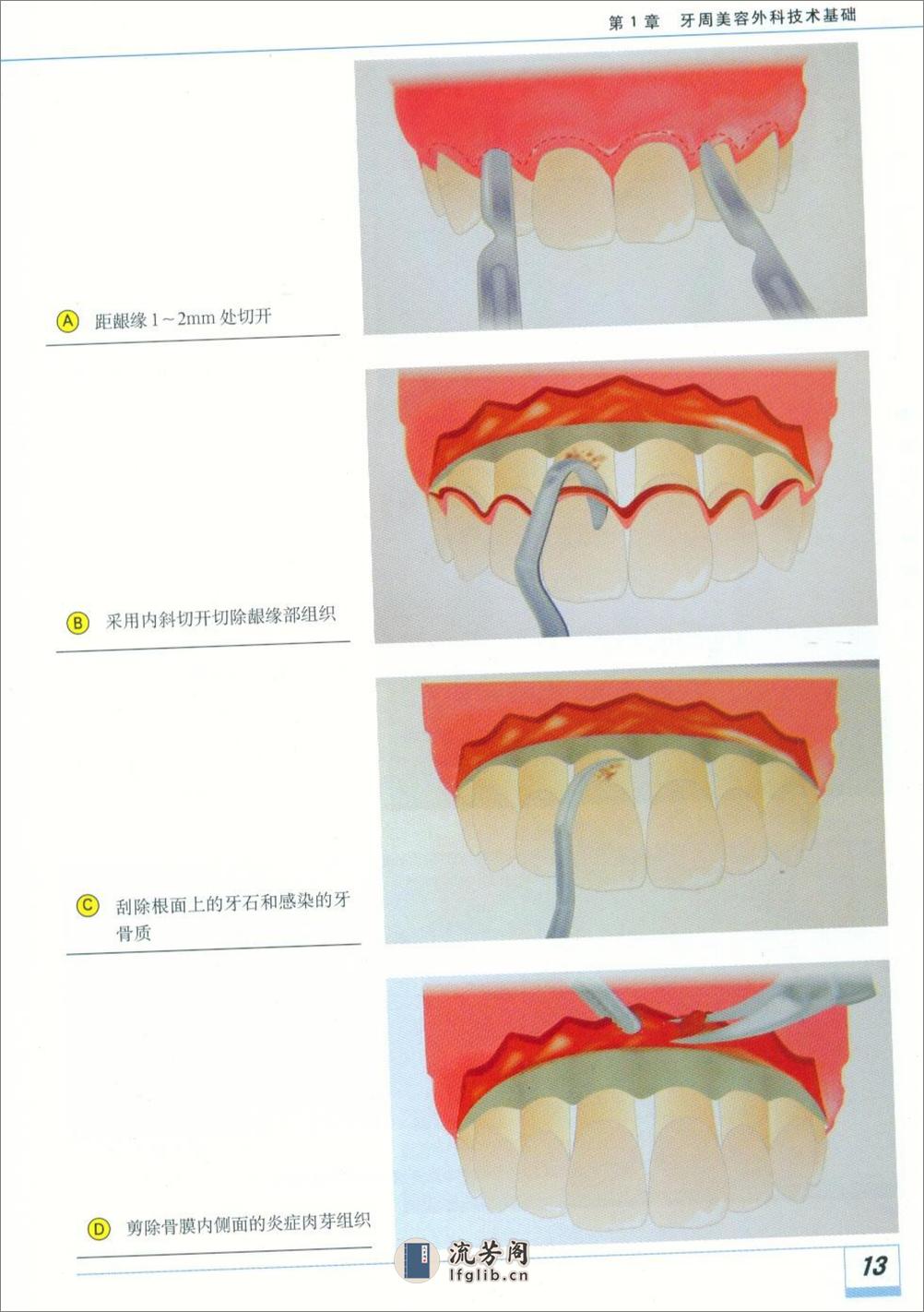 图解牙周美容外科实用技术 - 第20页预览图