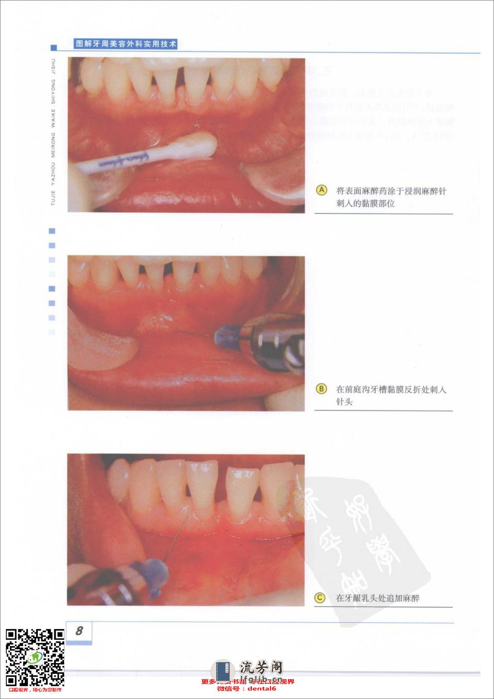 图解牙周美容外科实用技术(彩色大图) - 第18页预览图