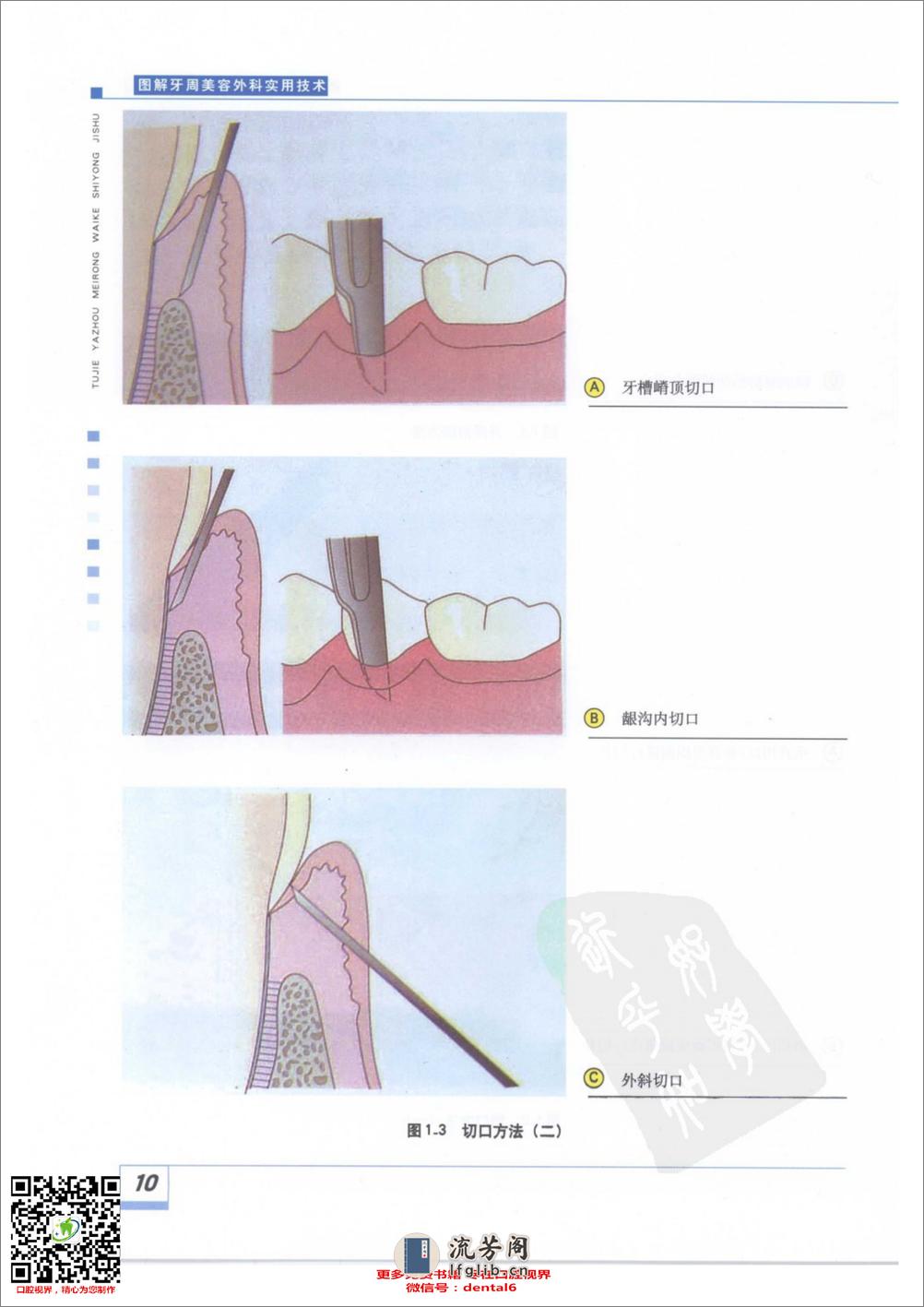图解牙周美容外科实用技术(彩色大图) - 第20页预览图