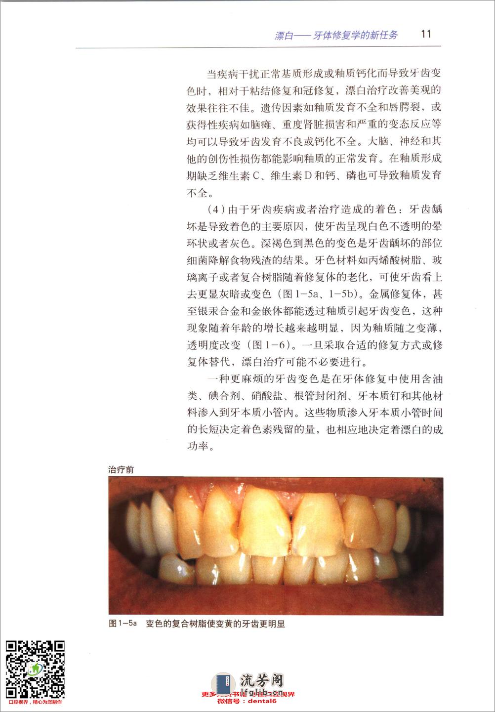 全牙列漂白 - 第19页预览图