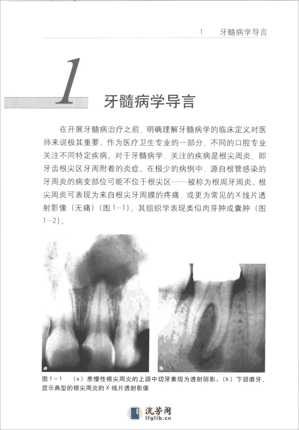 根管治疗临床指南+（中英文对照）_刘荣森20... - 第11页预览图