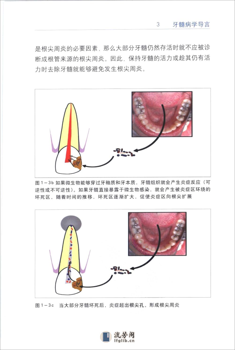 根管治疗临床指南+（中英文对照）_刘荣森20... - 第13页预览图