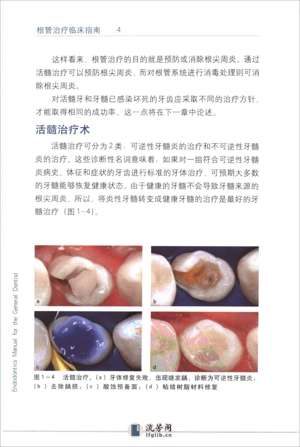 根管治疗临床指南+（中英文对照）_刘荣森20... - 第14页预览图