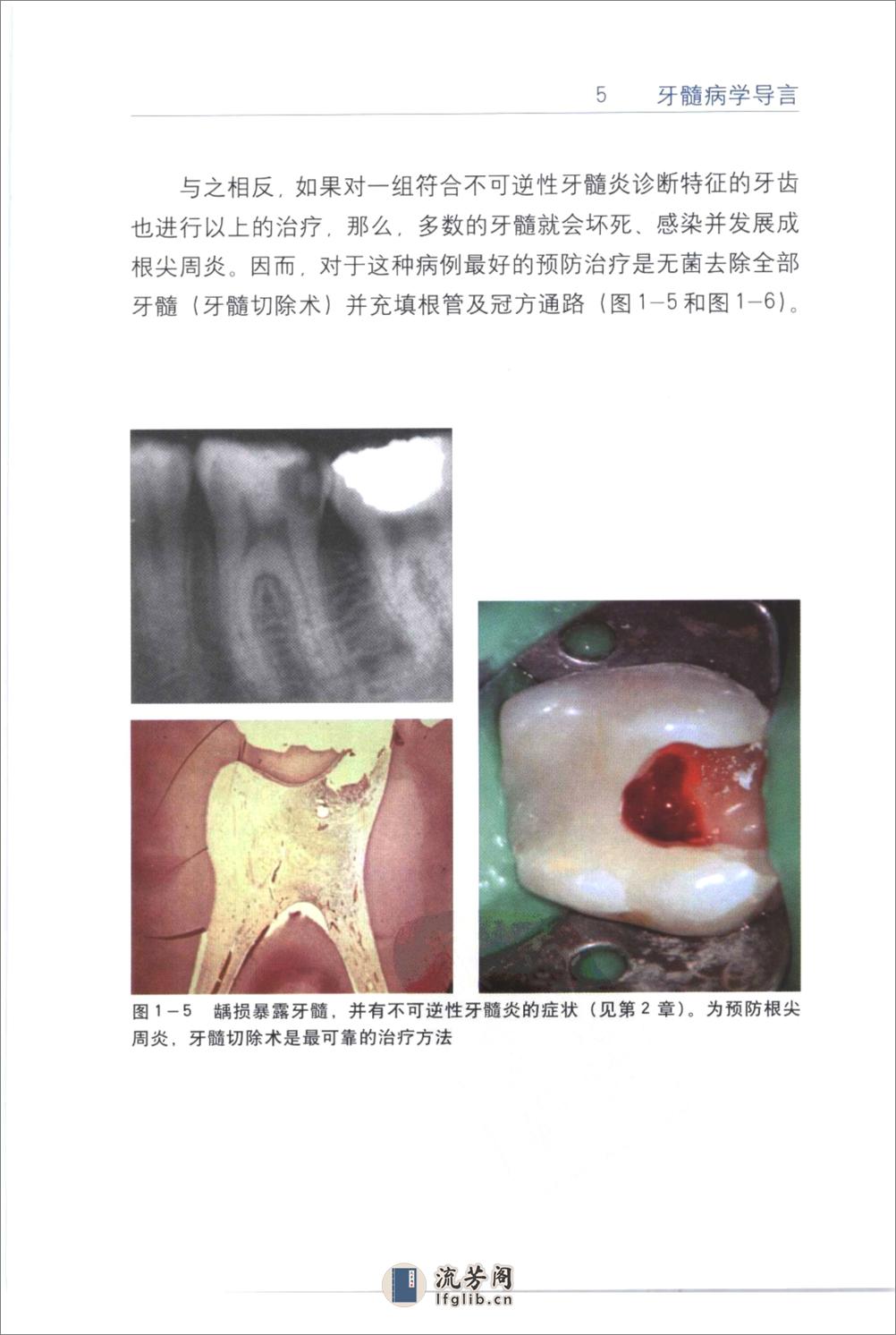 根管治疗临床指南+（中英文对照）_刘荣森20... - 第15页预览图