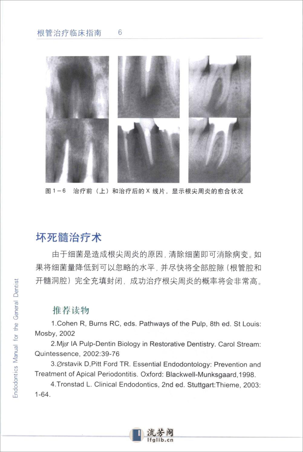 根管治疗临床指南+（中英文对照）_刘荣森20... - 第16页预览图