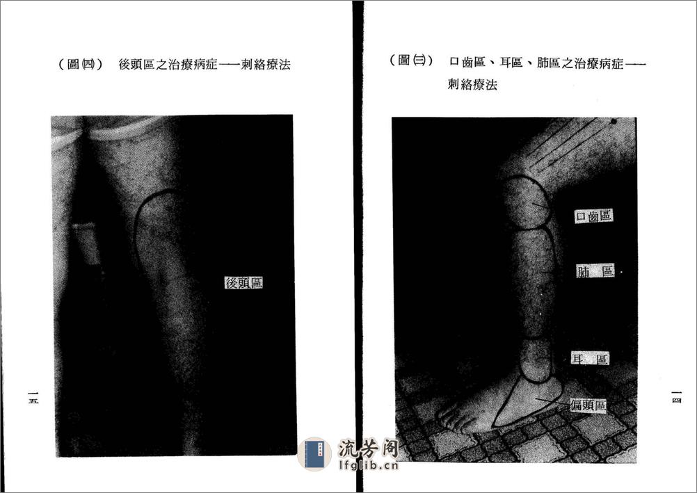 董氏针灸全集验证 - 第16页预览图