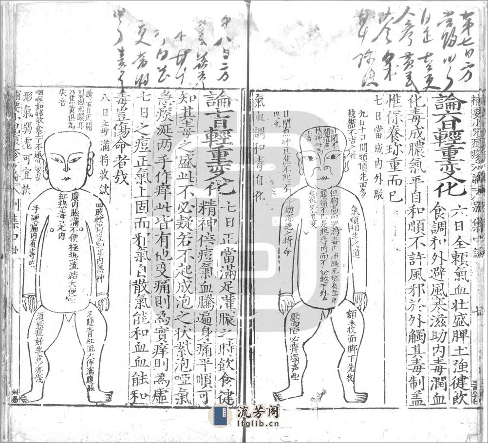 ＿補要小兒痘疹方論別集博愛心鑒二卷 一卷 - 第10页预览图