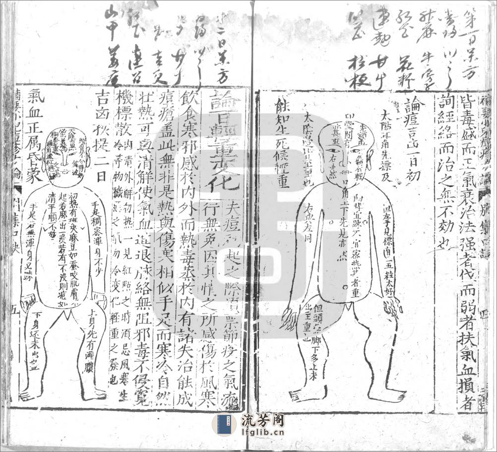 ＿補要小兒痘疹方論別集博愛心鑒二卷 一卷 - 第7页预览图