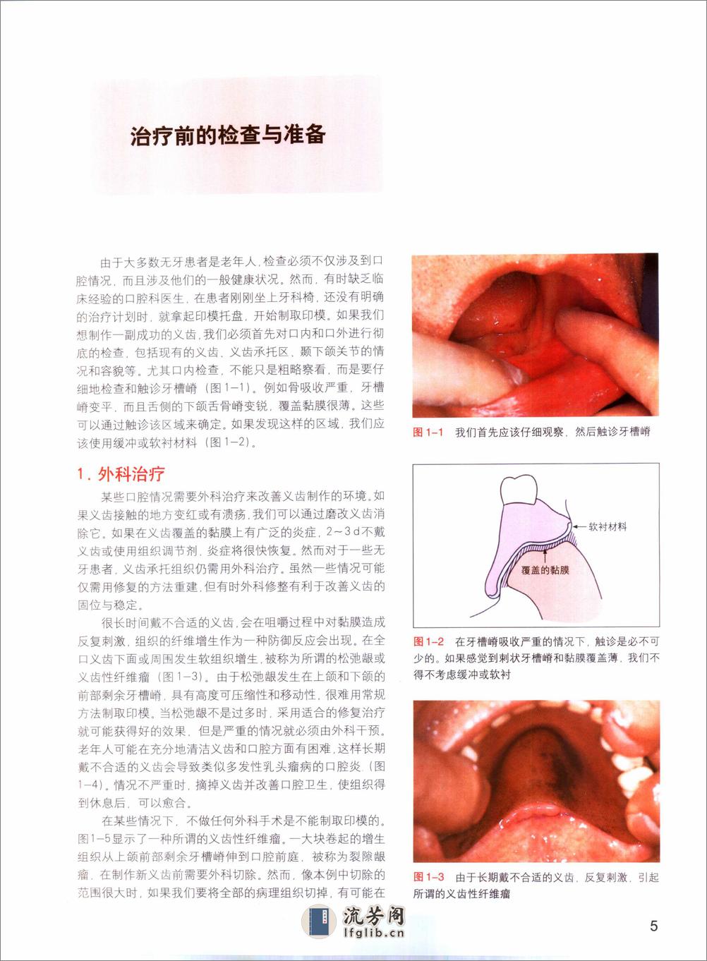 国际牙科名著系列—全口义齿原理与实践：塑... - 第15页预览图