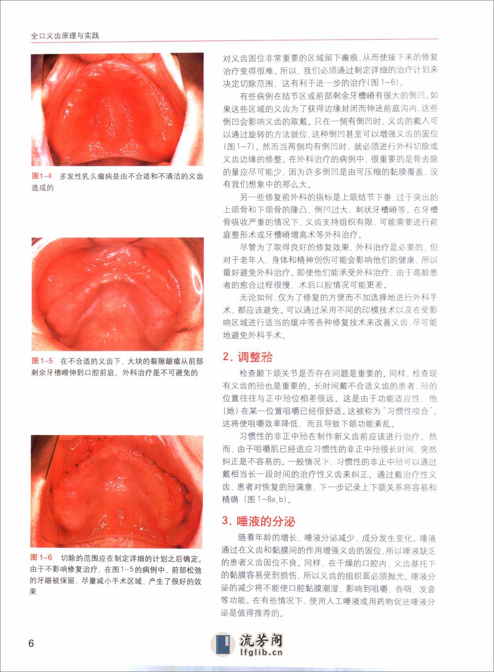 国际牙科名著系列—全口义齿原理与实践：塑... - 第16页预览图