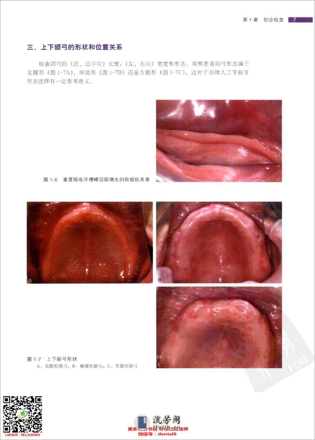 全口义齿临床修复规范_ - 第17页预览图