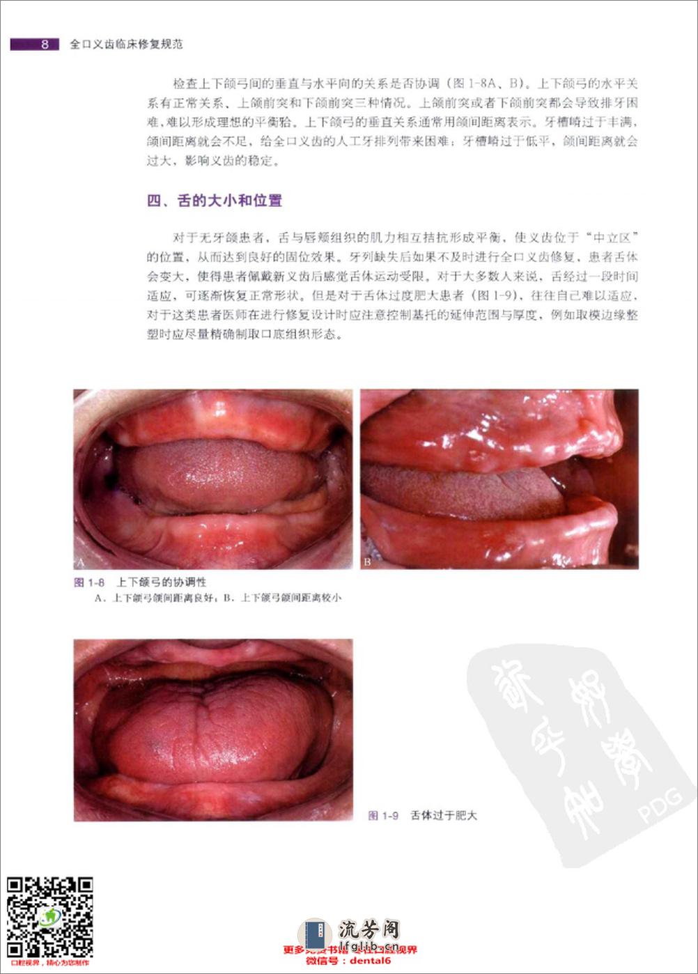 全口义齿临床修复规范_ - 第18页预览图