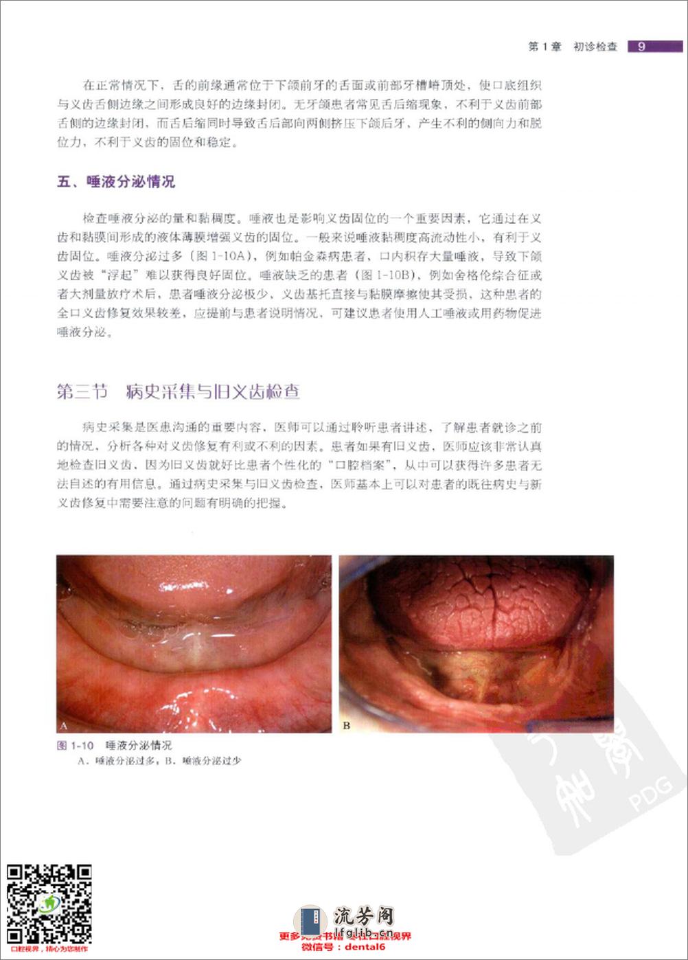 全口义齿临床修复规范_ - 第19页预览图