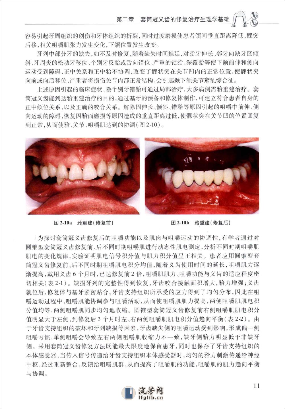 套筒冠义齿 - 第19页预览图