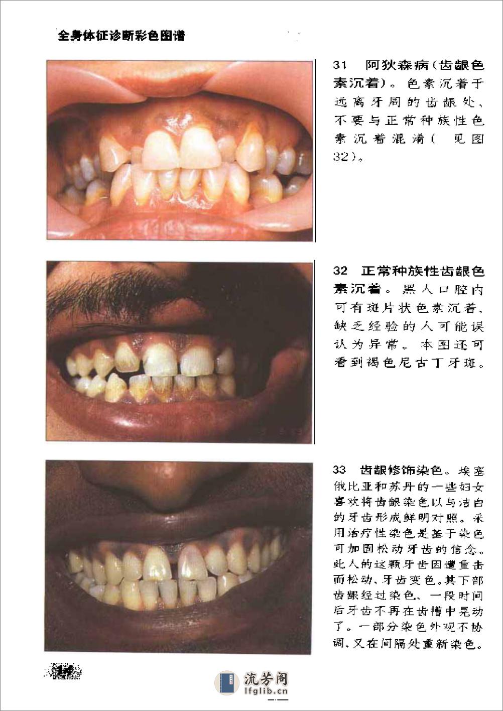 全身体征诊断彩色图谱——(美)Michael.Zatouroff-2000 - 第19页预览图