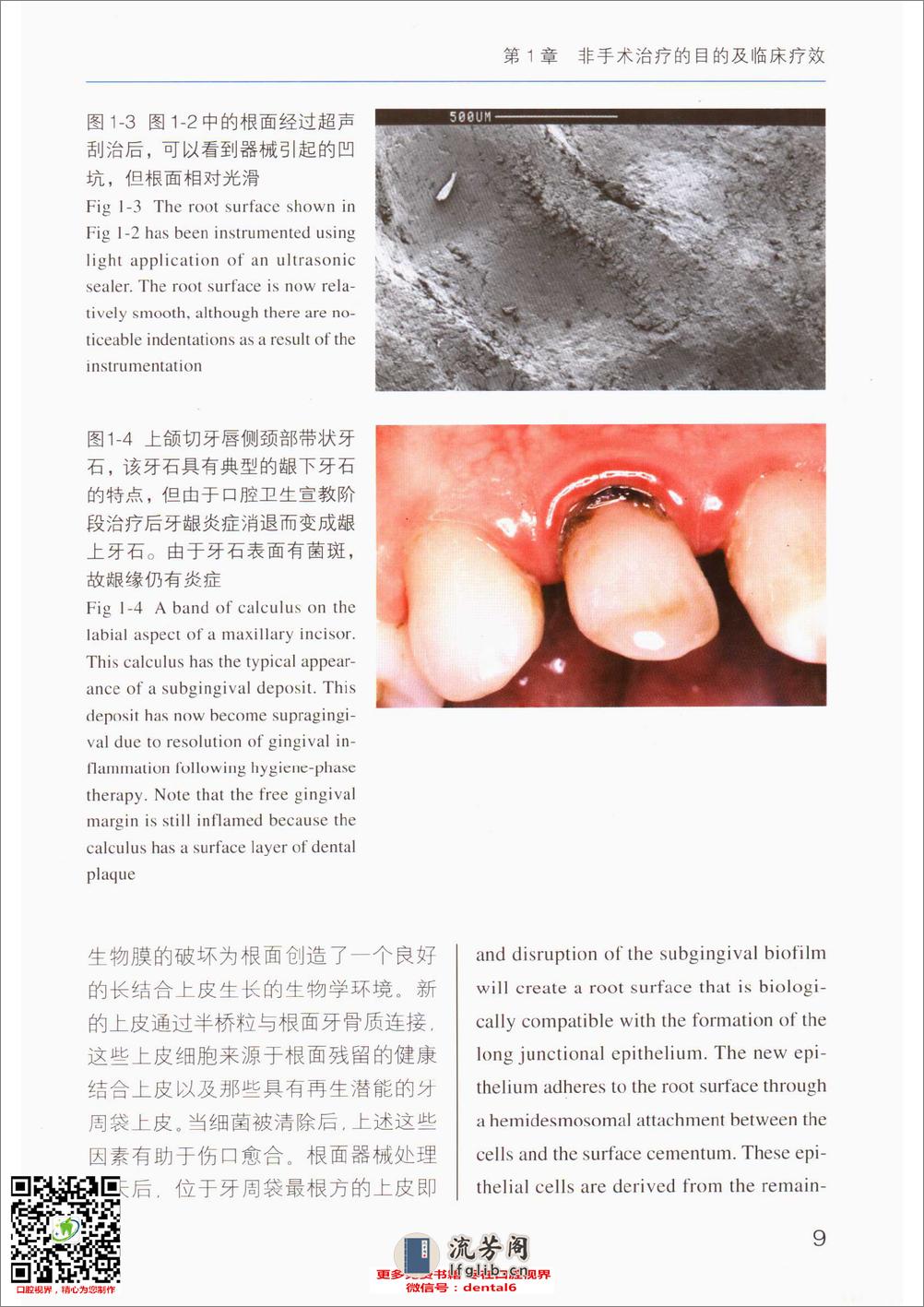 牙周非手术治疗 - 第18页预览图