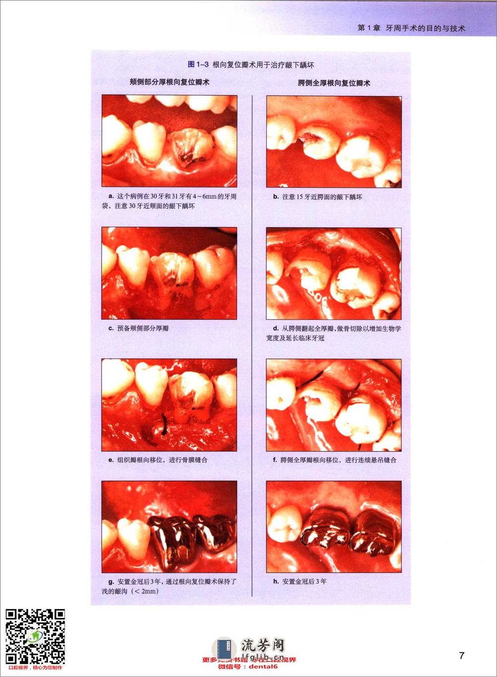 牙周外科学临床图谱 - 第19页预览图