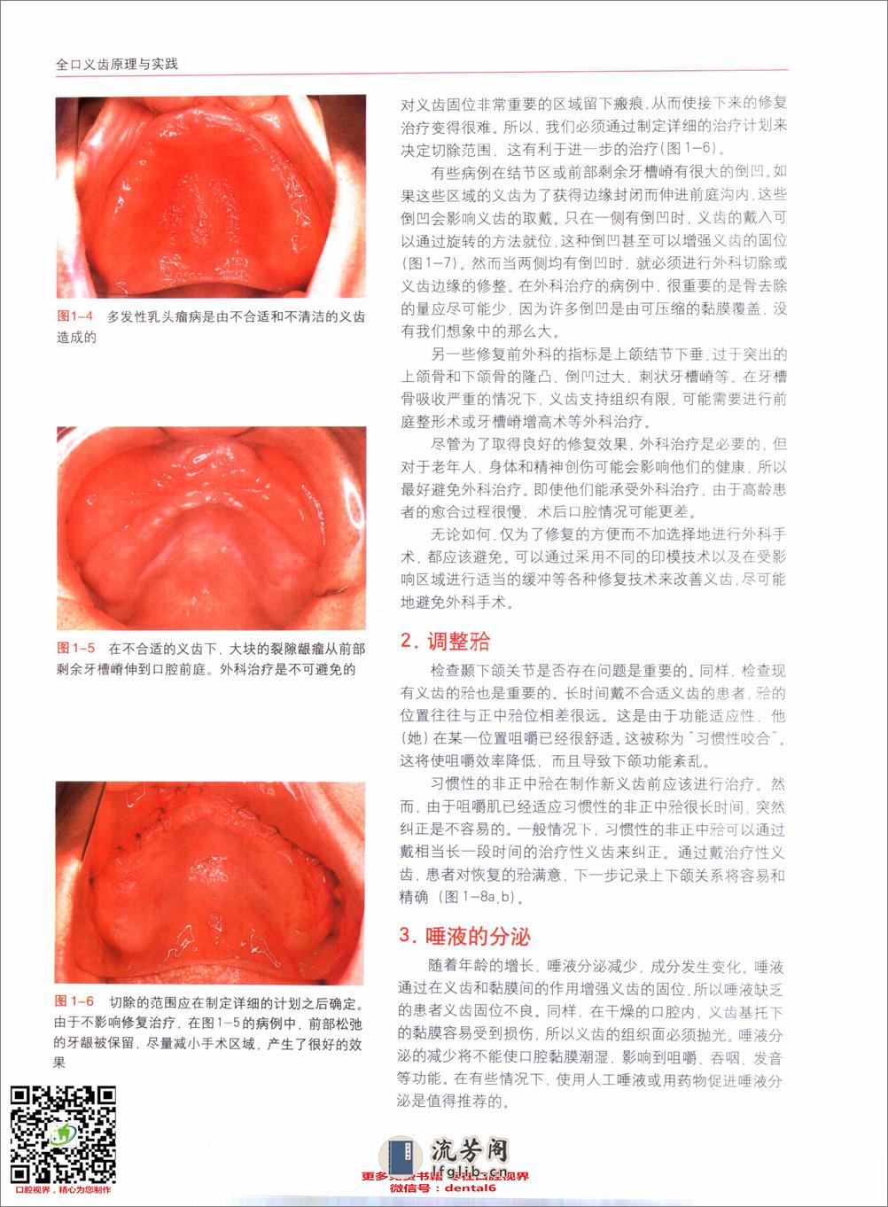 国际牙科名著系列—全口义齿原理与实践：塑... - 第16页预览图
