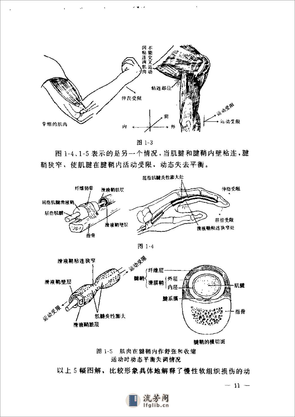 针刀临床诊断与治疗 - 第20页预览图