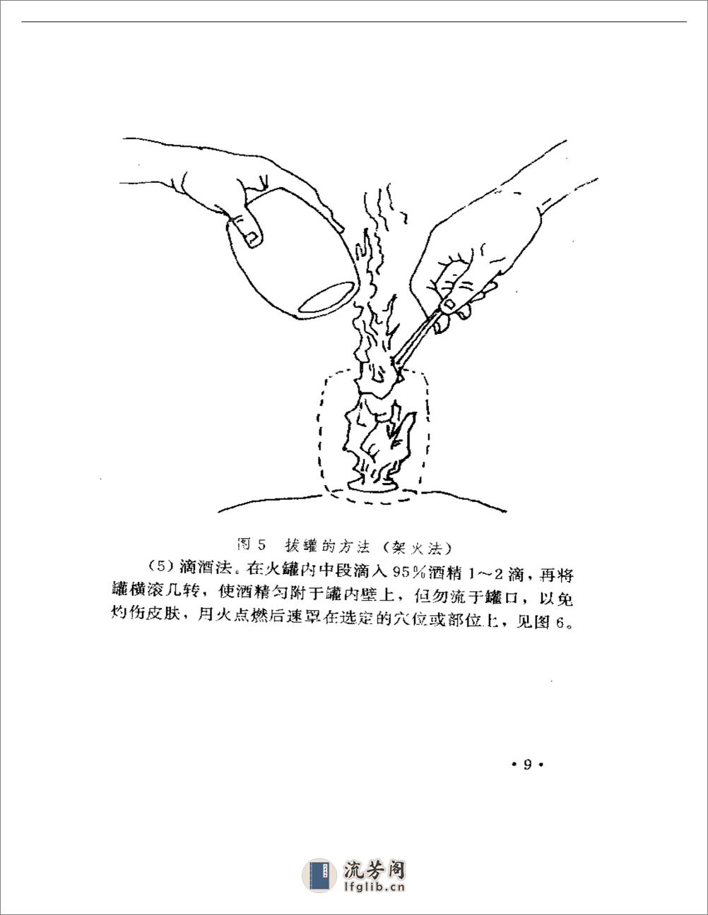 火罐疗法精粹 - 第14页预览图