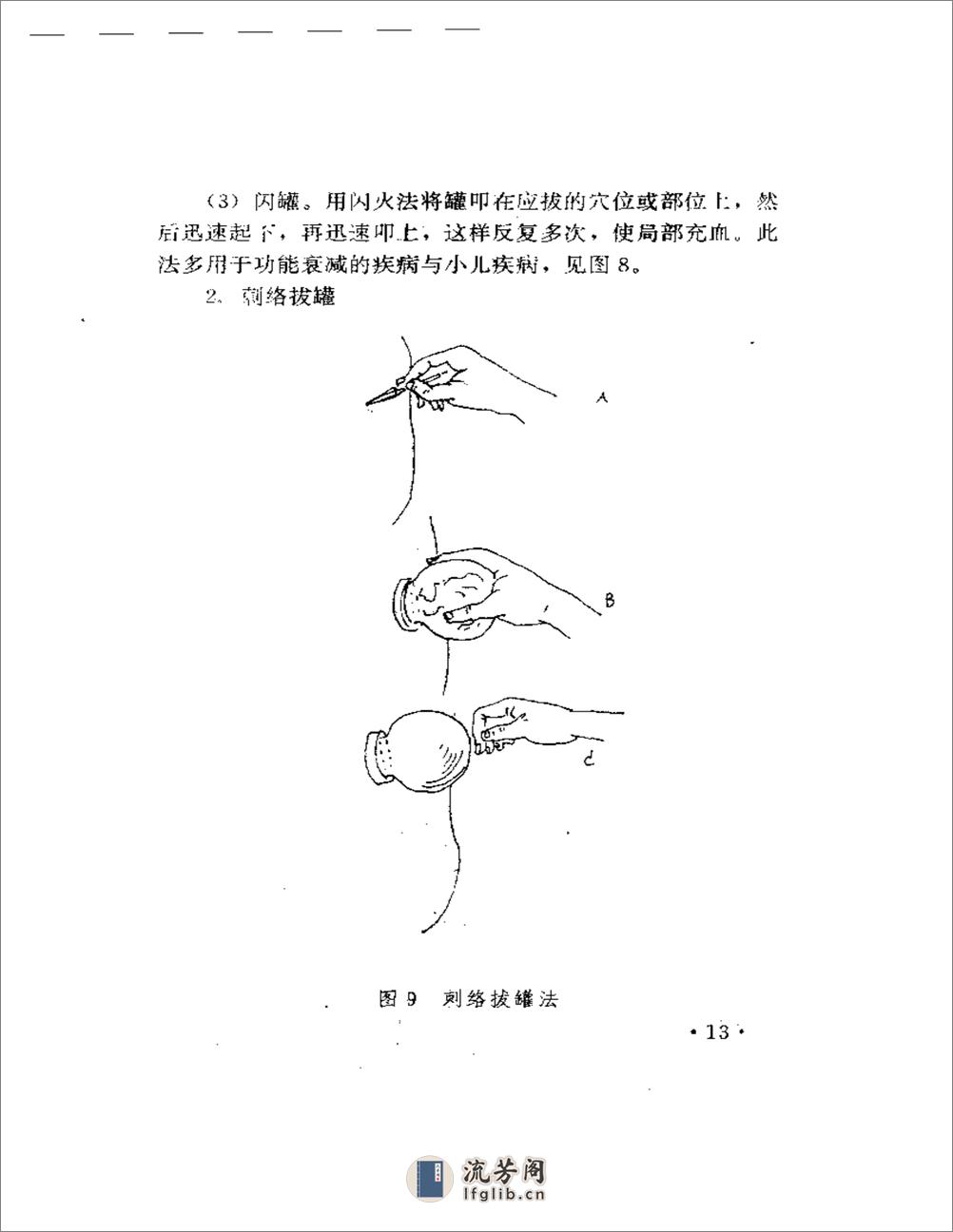 火罐疗法精粹 - 第18页预览图