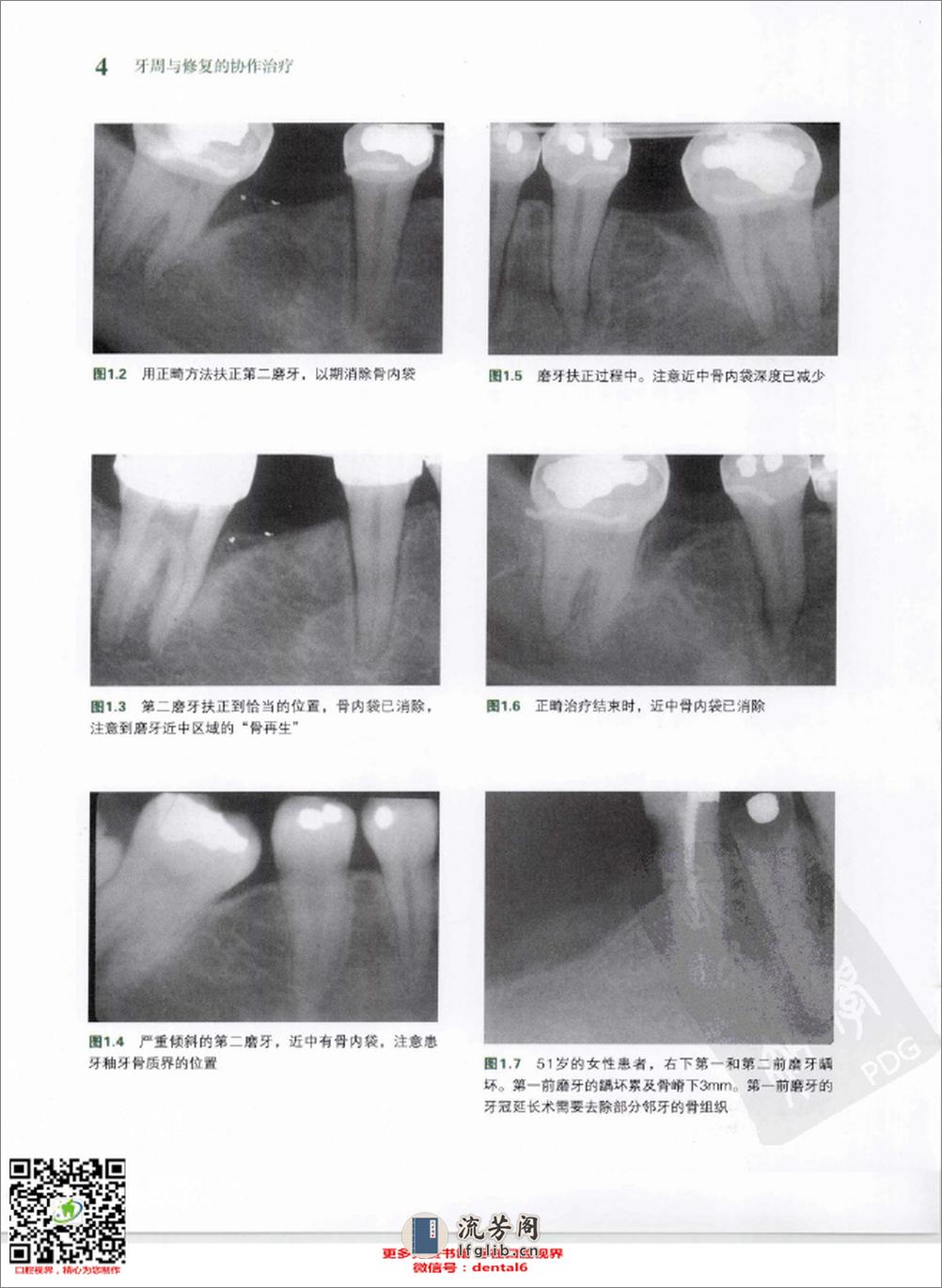 牙周与修复的协作治疗++治疗成功的保障 - 第10页预览图