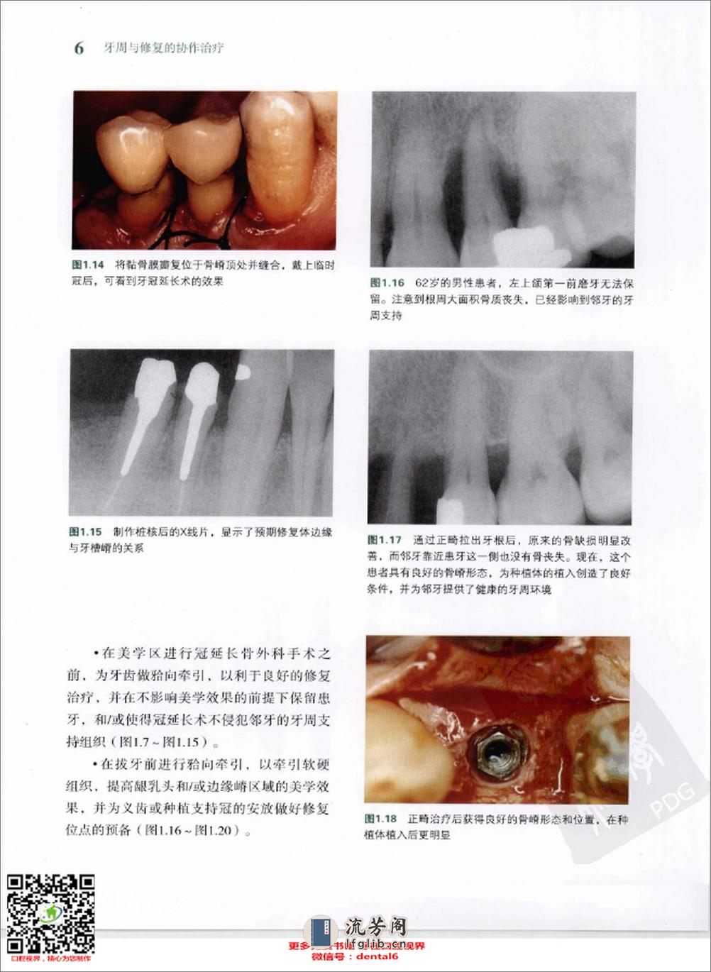 牙周与修复的协作治疗++治疗成功的保障 - 第12页预览图