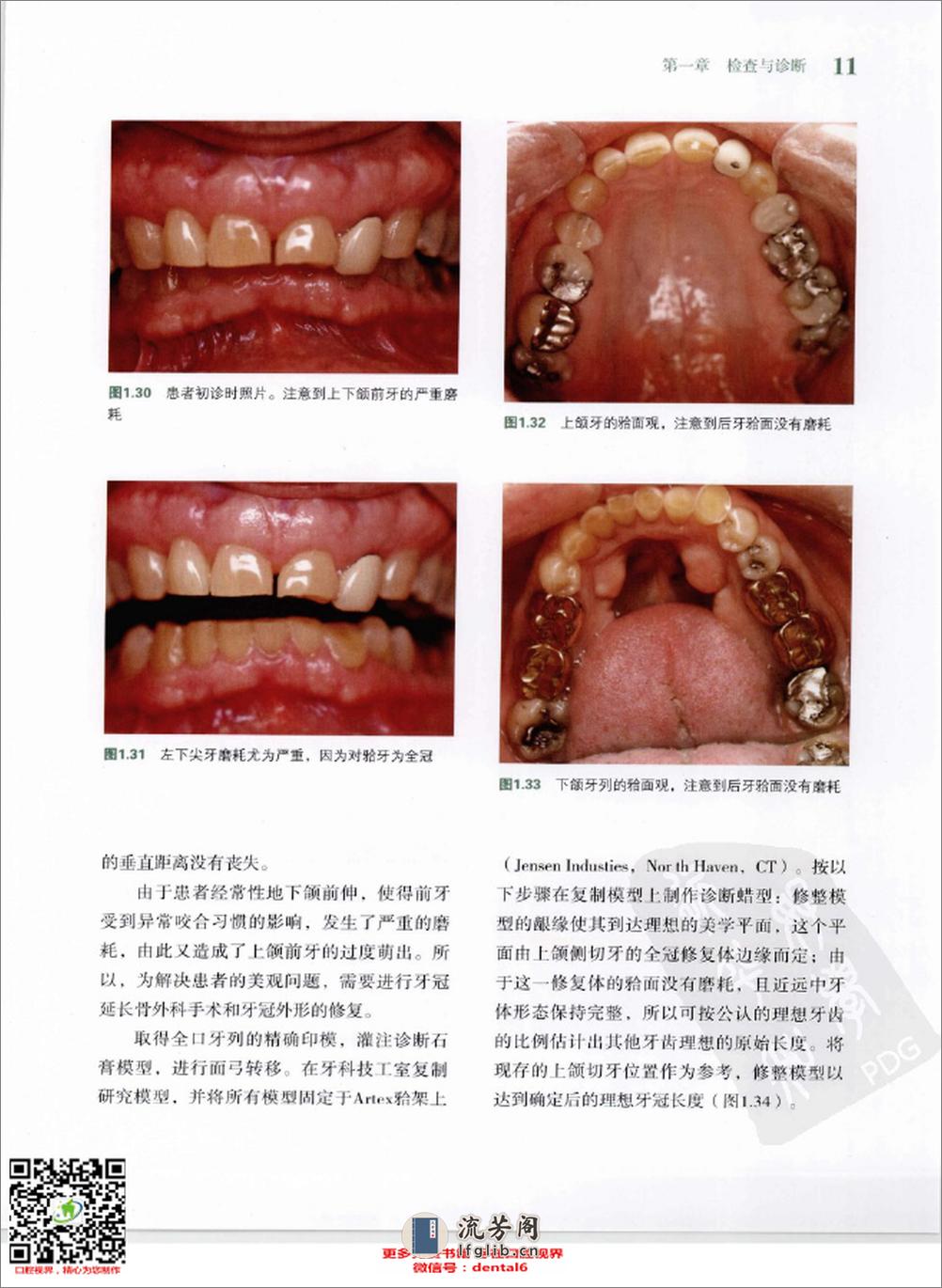 牙周与修复的协作治疗++治疗成功的保障 - 第17页预览图