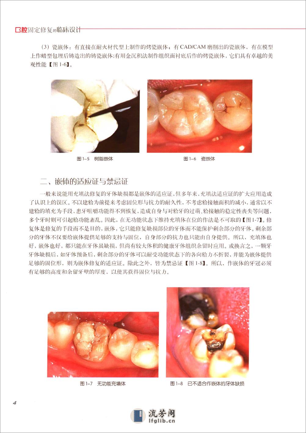 口腔固定修复的临床设计 - 第11页预览图