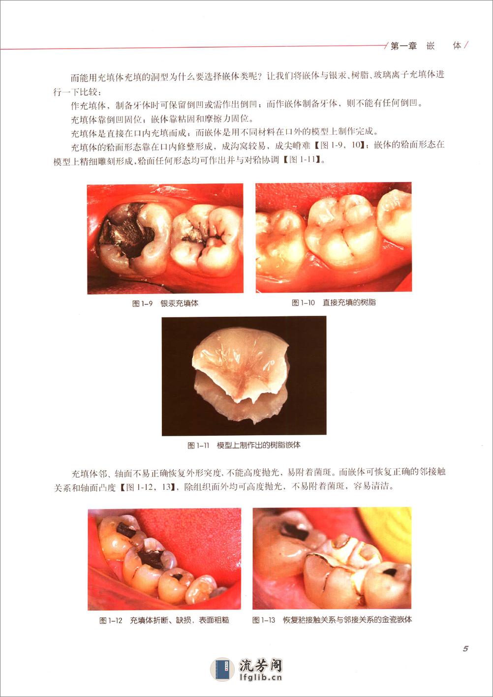 口腔固定修复的临床设计 - 第12页预览图