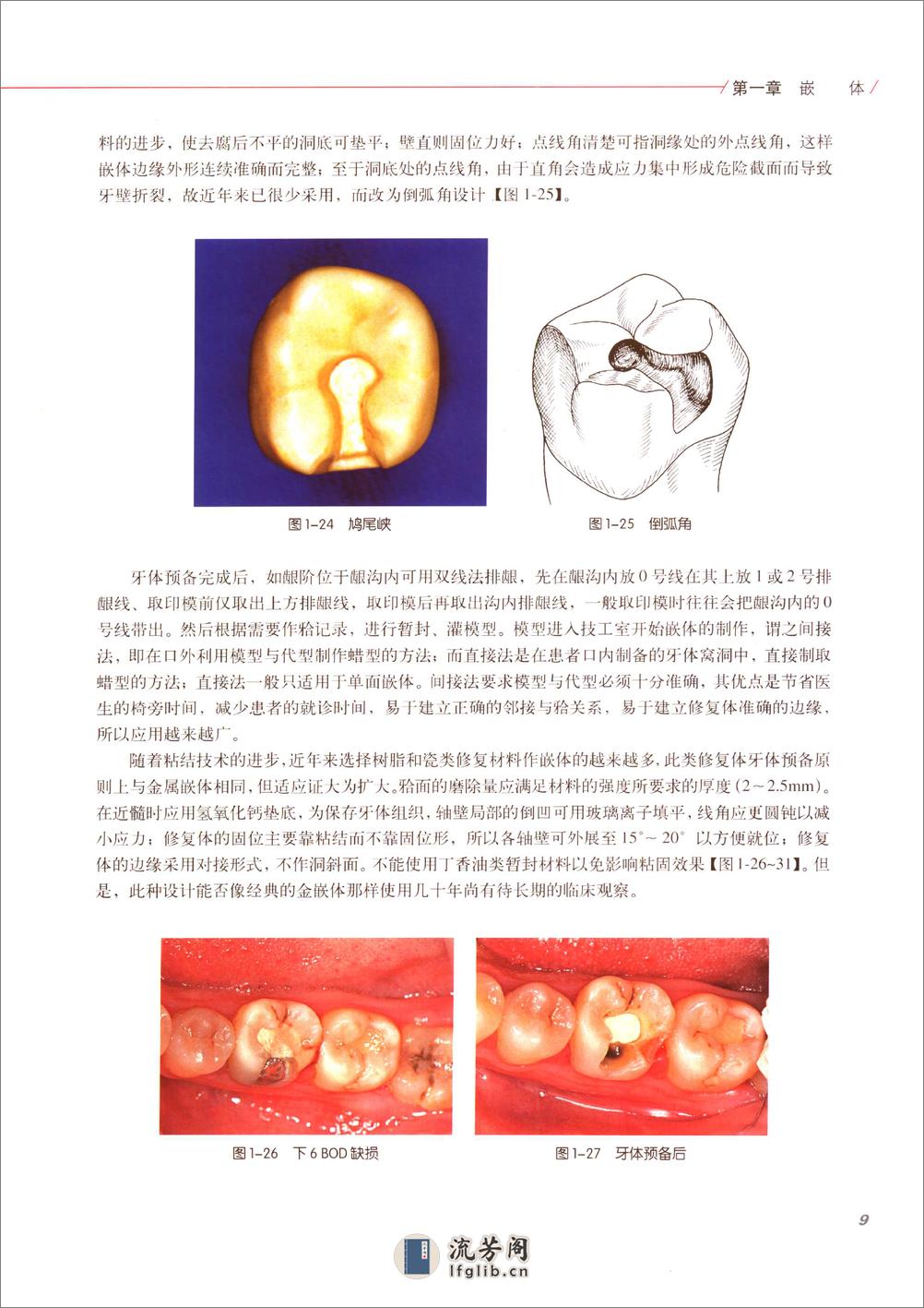 口腔固定修复的临床设计 - 第16页预览图