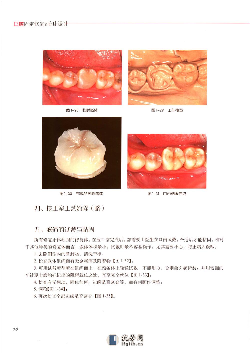 口腔固定修复的临床设计 - 第17页预览图