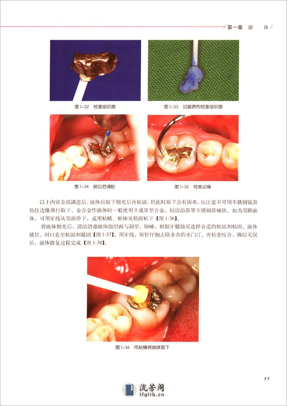 口腔固定修复的临床设计 - 第18页预览图