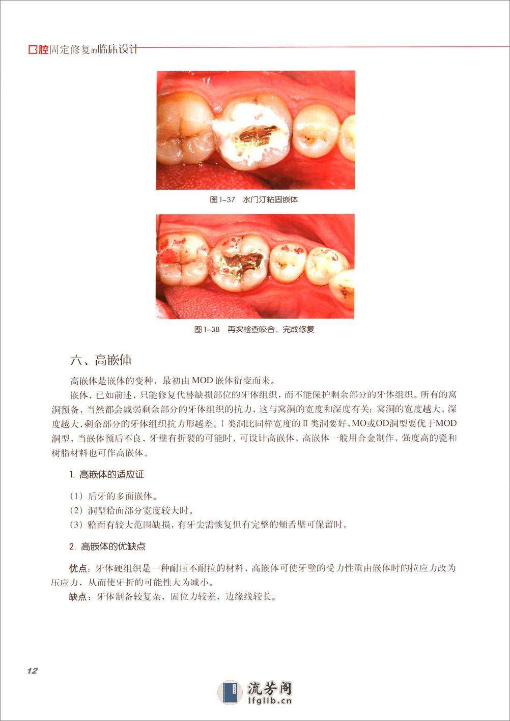 口腔固定修复的临床设计 - 第19页预览图